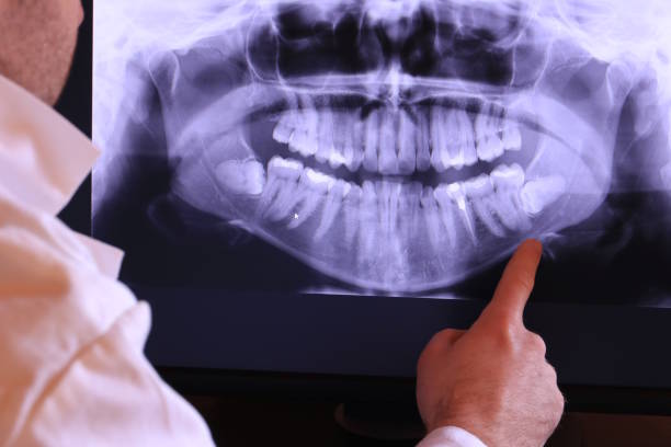 Best Urgent Care for Lost Fillings or Crowns in Kendall Park, NJ