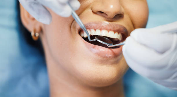 Best Emergency Dental Care for Broken or Chipped Teeth in Kendall Park, NJ