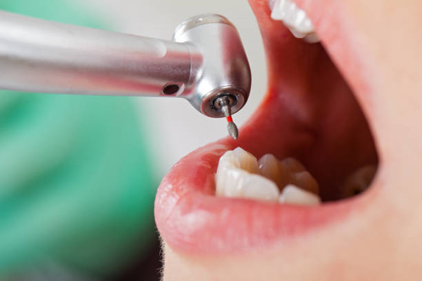 Best Emergency Gum Treatment in Kendall Park, NJ